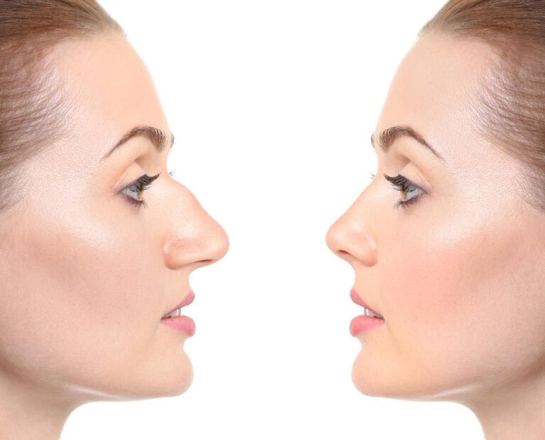 Is There Such a Thing as the Perfect Nose Shape? 2021 Guide Emlii